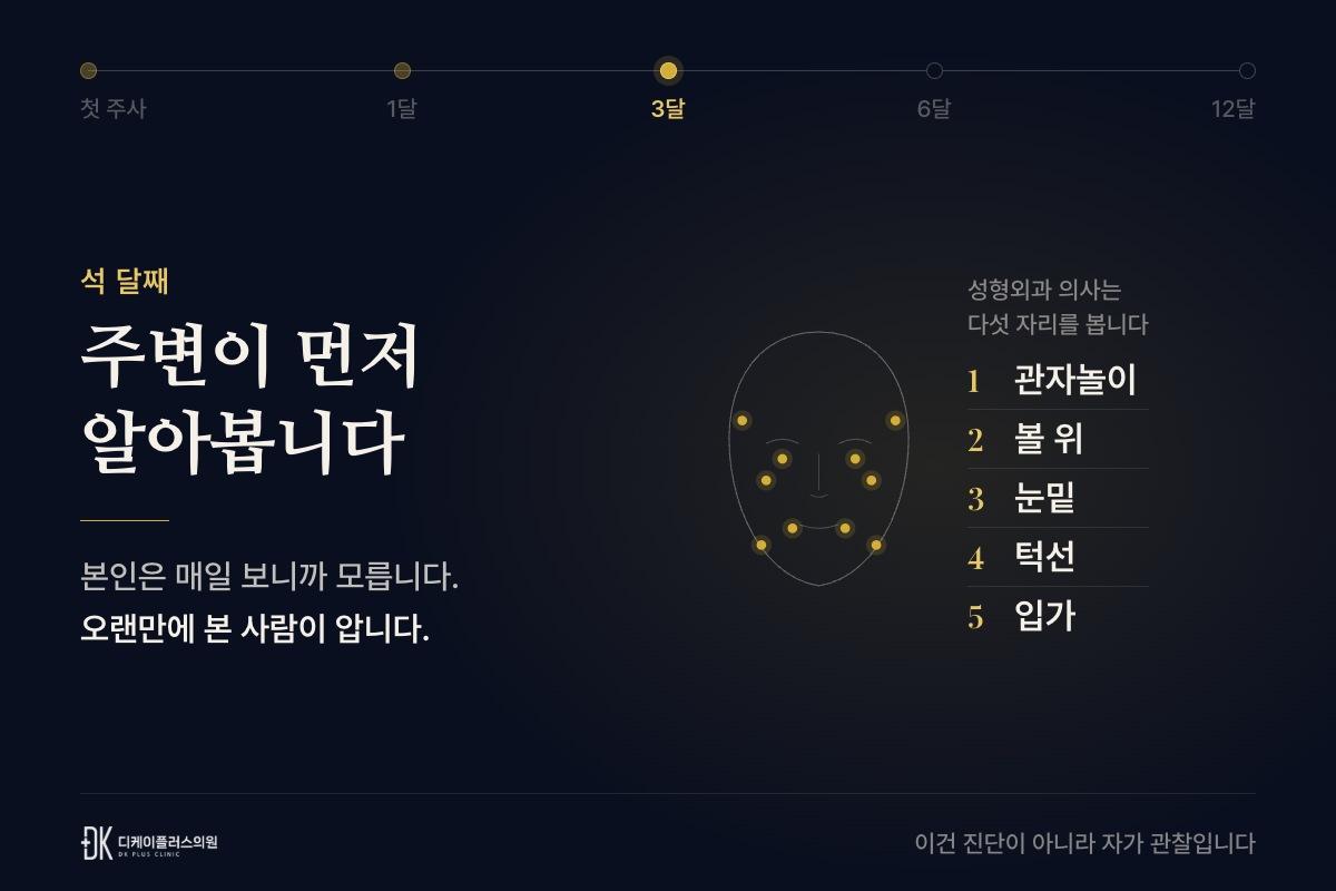석 달째 — 성형외과 의사가 보는 다섯 자리: 관자놀이, 볼 위, 눈밑, 턱선, 입가