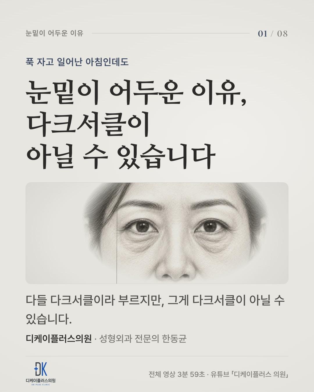 눈밑이 어두운 이유, 다크서클이 아닐 수 있습니다