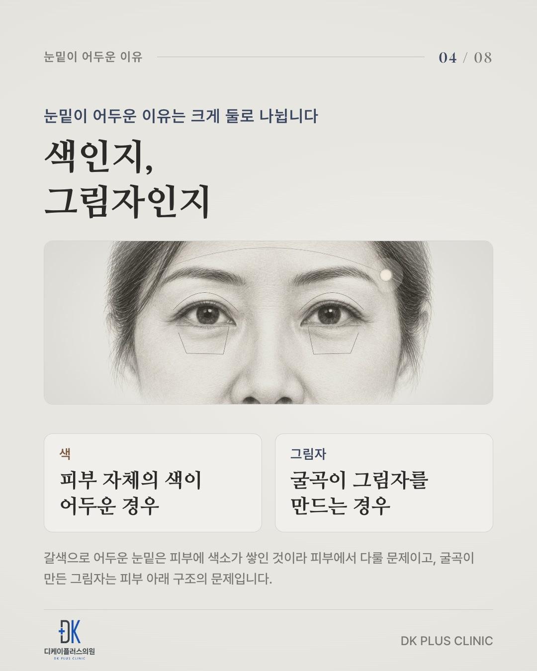 눈밑이 어두운 이유는 크게 둘 — 피부 자체의 색, 굴곡이 만드는 그림자