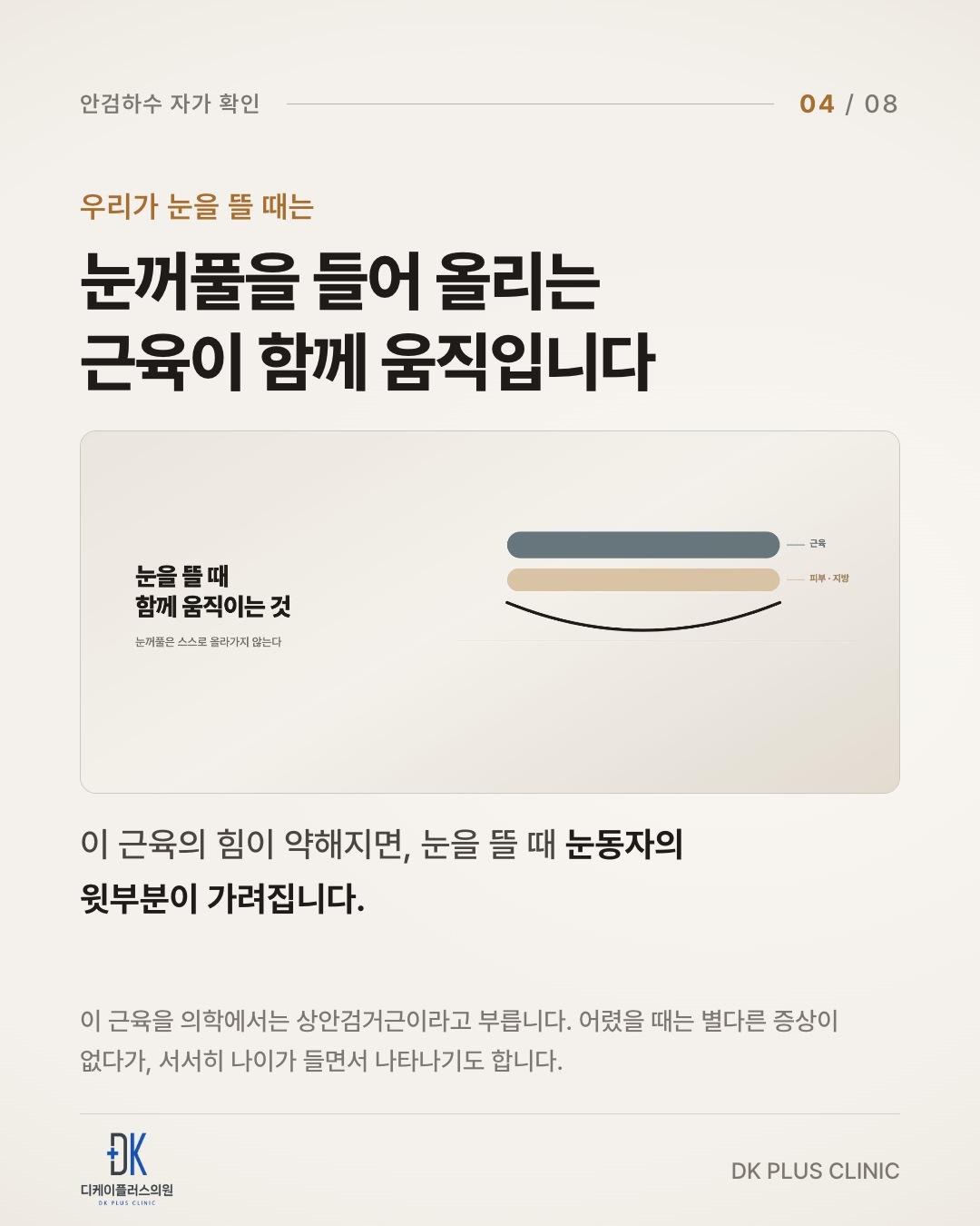 눈을 뜰 때는 눈꺼풀을 들어 올리는 근육이 함께 움직인다