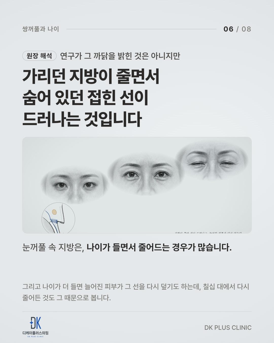 가리던 지방이 줄면서, 숨어 있던 접힌 선이 드러난다 — 원장 해석