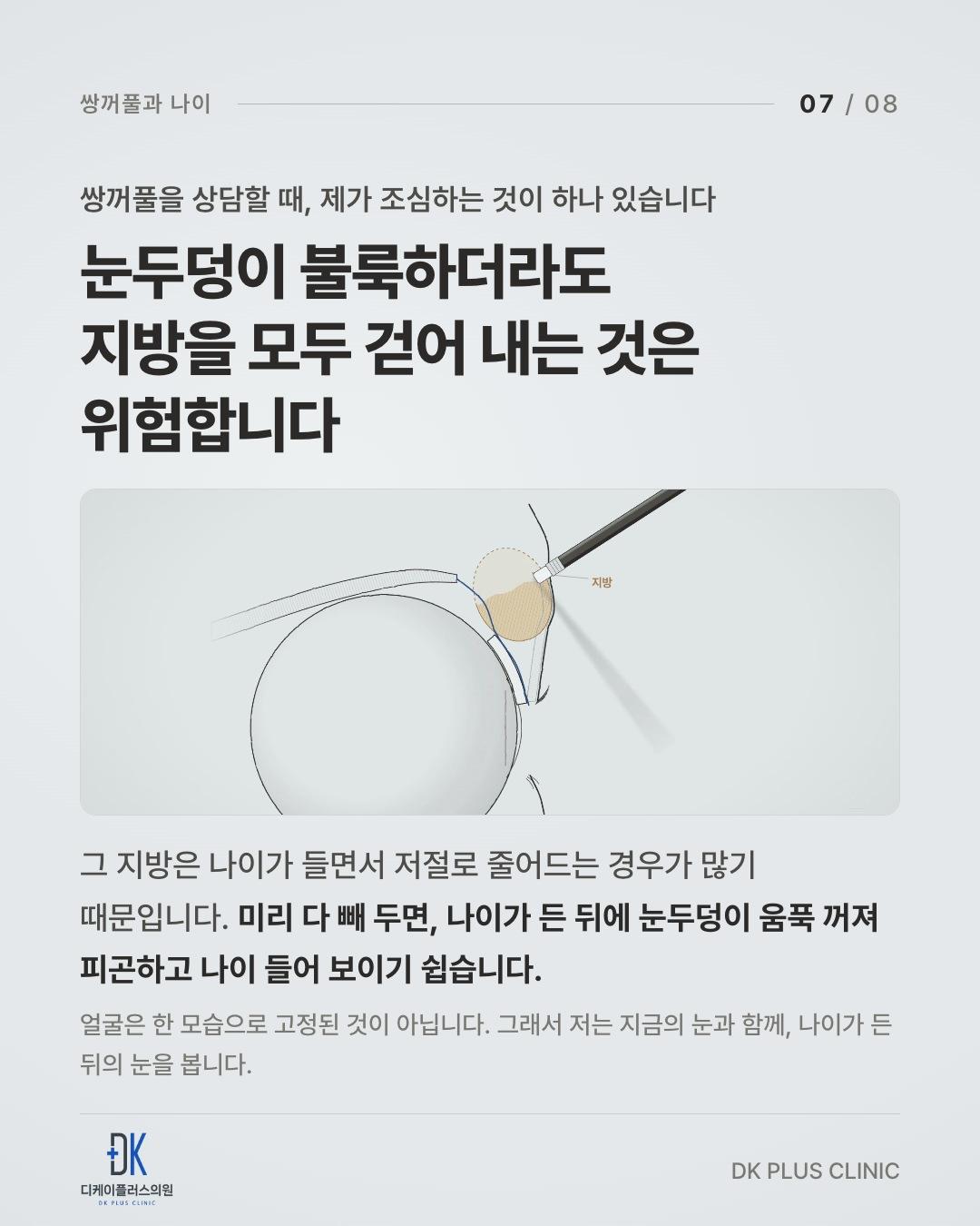 눈두덩이 불룩하더라도, 지방을 모두 걷어 내는 것은 위험하다