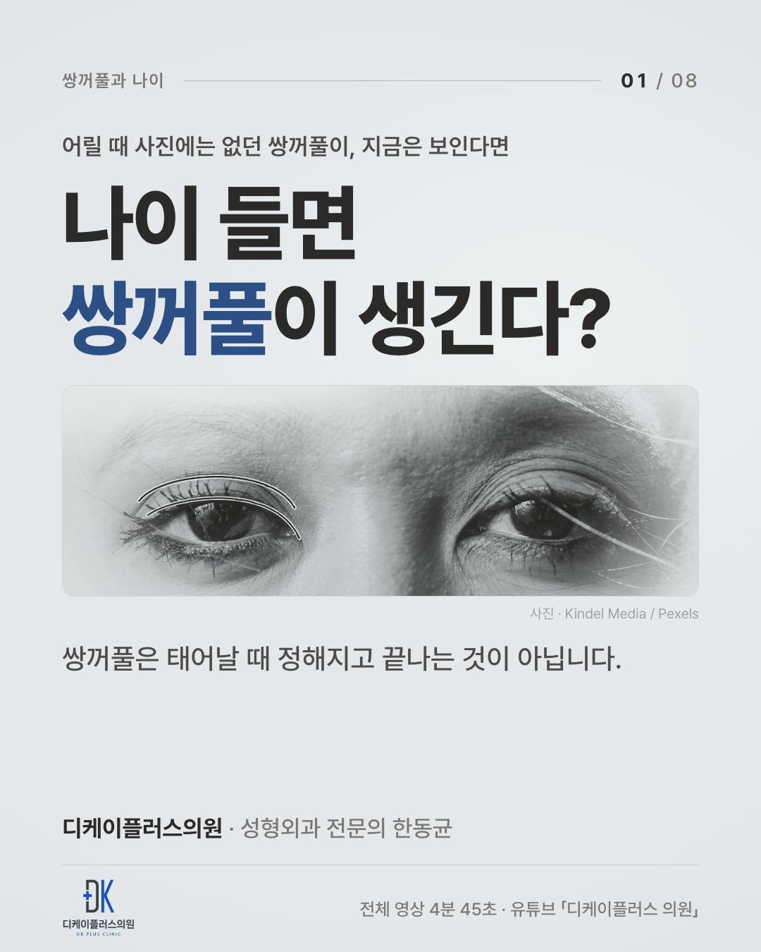 어릴 땐 없던 쌍꺼풀, 나이 들어 생기는 이유는 눈꺼풀 지방?