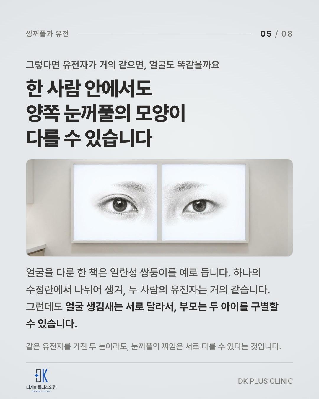 한 사람 안에서도 양쪽 눈꺼풀의 모양이 다를 수 있다