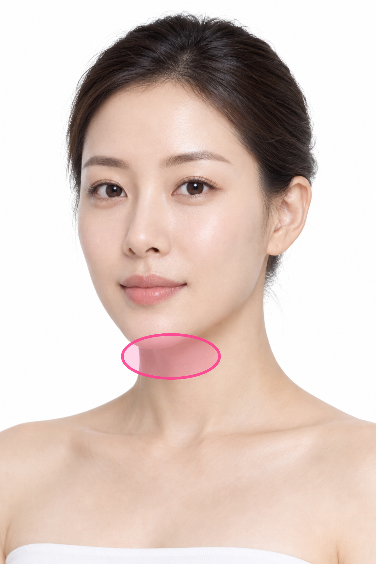 아큐스컬프 이중턱 부위 안내 그림