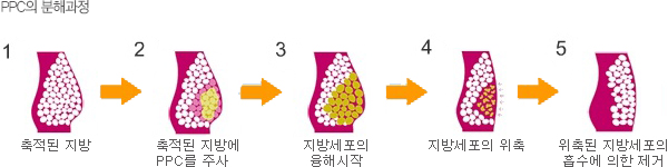 PPC 지방 분해 과정 도해